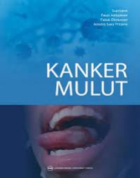 Image of Kanker Mulut